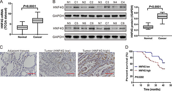 Expression of HNF4G in lung cancer tissues and normal lung tissues.