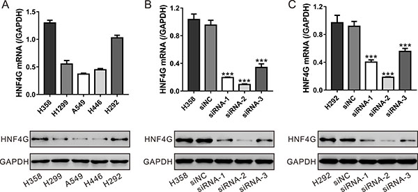 Suppressing of HNF4G expression by siRNA transfection.
