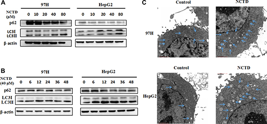 NCTD induces autophagy in HCC cells.