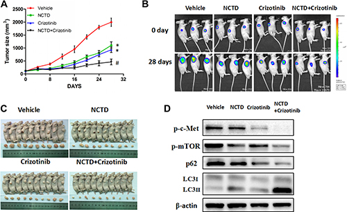 NCTD alone or combined with crizotinib inhibits tumor growth in a xenograft mouse model.