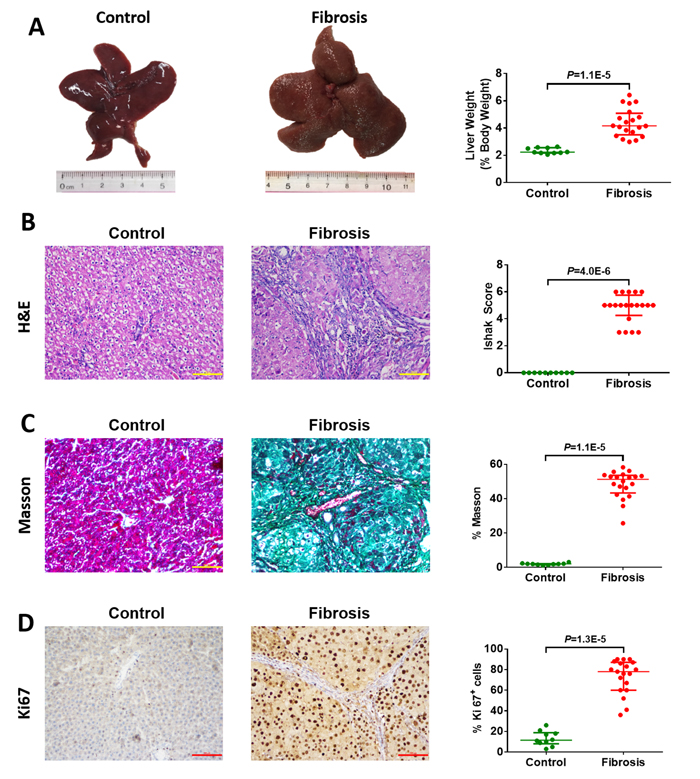 Macroscopic and microscopic findings on control liver tissue (n=10) and diethylnitrosamine (DEN)-induced hepatofibrotic liver tissue (n=20) in male rats.