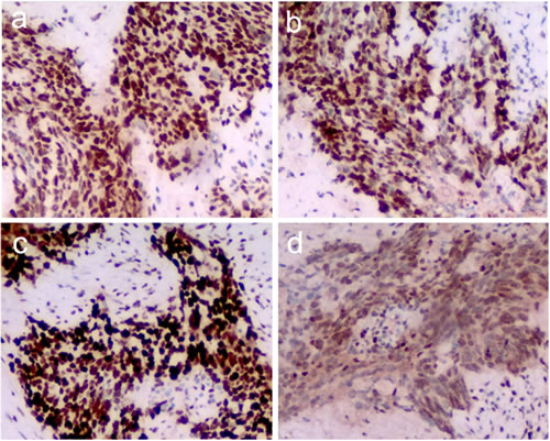 Immunohistochemistry for the mismatch repair (MMR) protein.