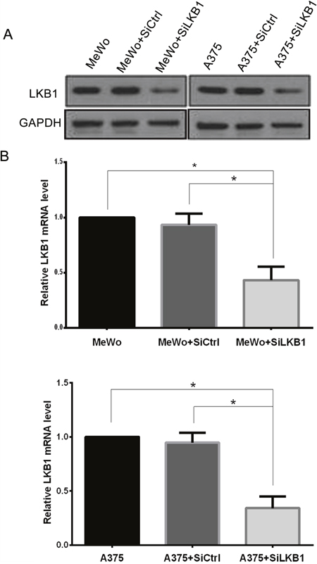 Knockdown of LKB1 in A375 and MeWo cells was confirmed by western blot analysis and qRT-PCR.