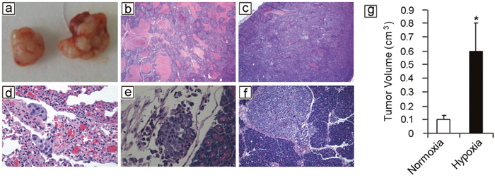 Hypoxia potentiates melanoma growth and metastasis in vivo.