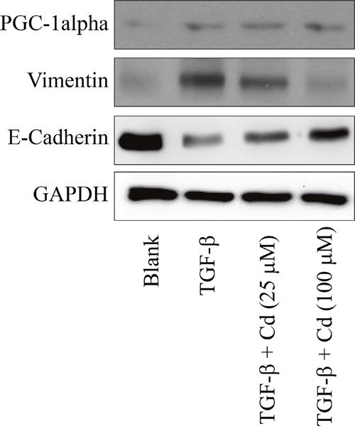 The effects of cordycepin (Cd) on PGC-1alpha and EMT markers (vimentin and E-cadherin) in TGF-beta-induced SKOV-3 cancer stem cells.
