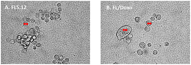Morphology of FL5.12 and FL/Doxo cells.