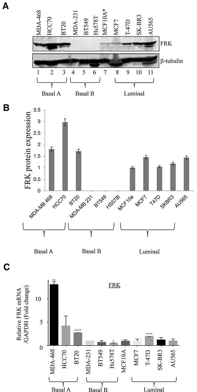 FRK expression in breast cancer cell lines.