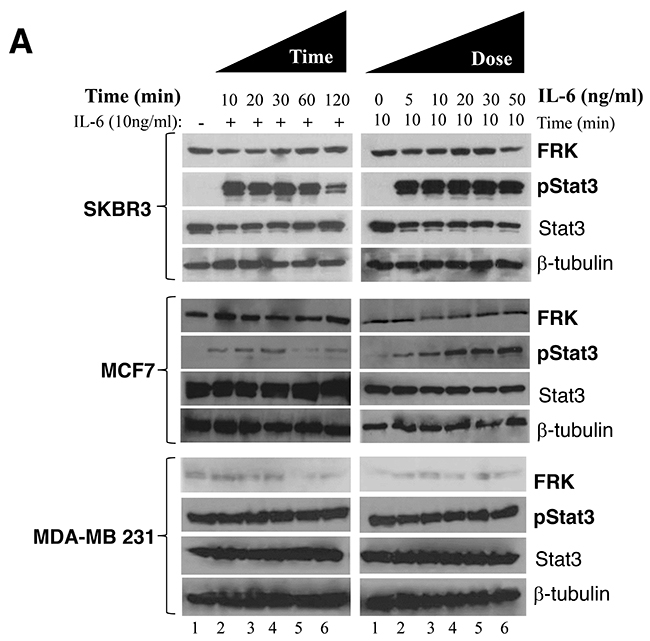 Effect of FRK overexpression and knockdown on STAT3 phosphorylation.