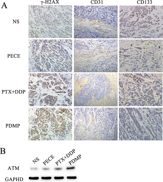 Immunohistochemical analysis of &#x03B3;-H2AX, CD133 and CD31 and Western blot of ATM in xenografts from mice in various groups.