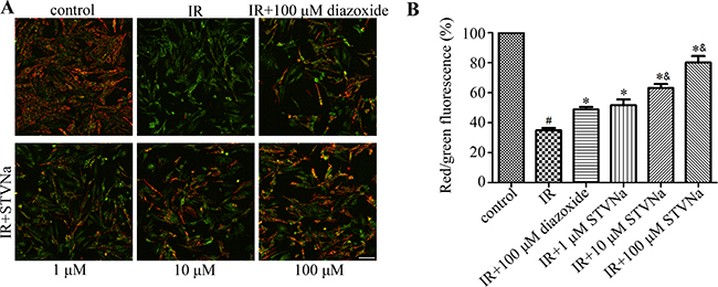 Effect of STVNa on mitochondrial membrane potential after IR.