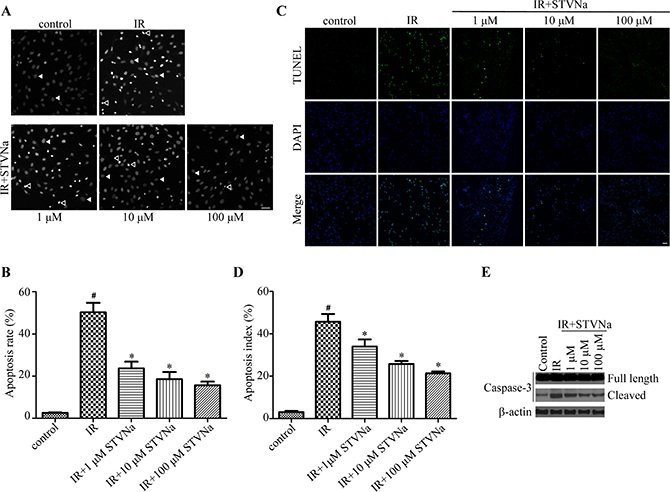 STVNa inhibited IR-induced cell apoptosis.