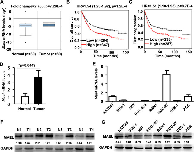 Expression and prognostic significance of MAEL gene in gastric cancer.