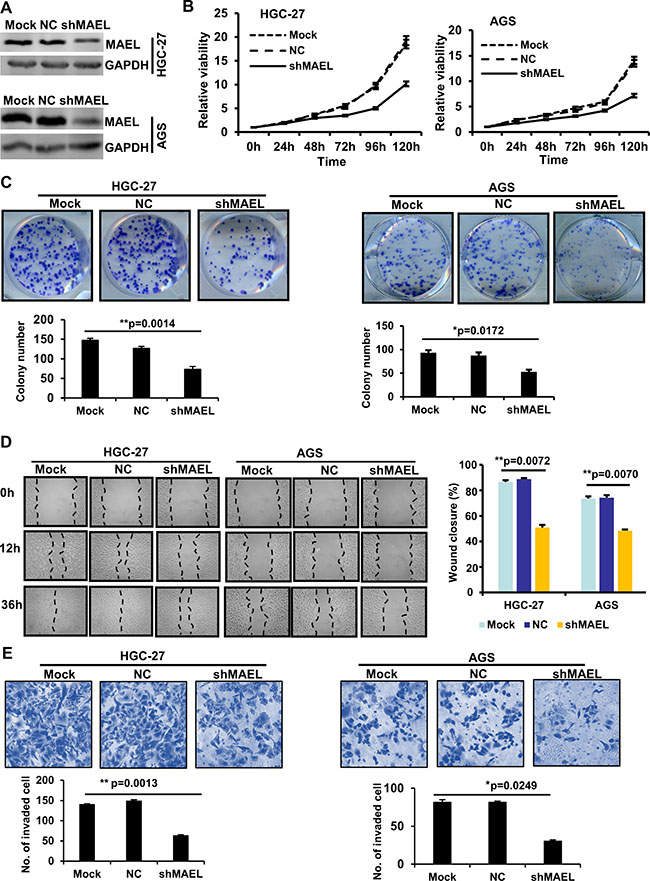 MAEL knockdown inhibits proliferation, migration and invasion in HGC-27 and AGS GC cells.