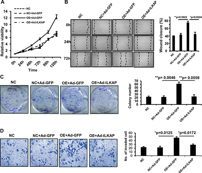 Adenovirus-mediated ILKAP overexpression suppresses the oncogenic roles of MAEL.