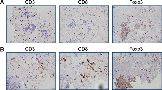 Results of immunohistological staining of samples from SD patient.