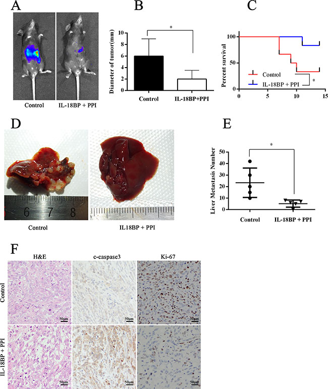 The combination of IL-18BP and PD-L1/PD-1 inhibitors suppressed PC cell growth and metastasis.