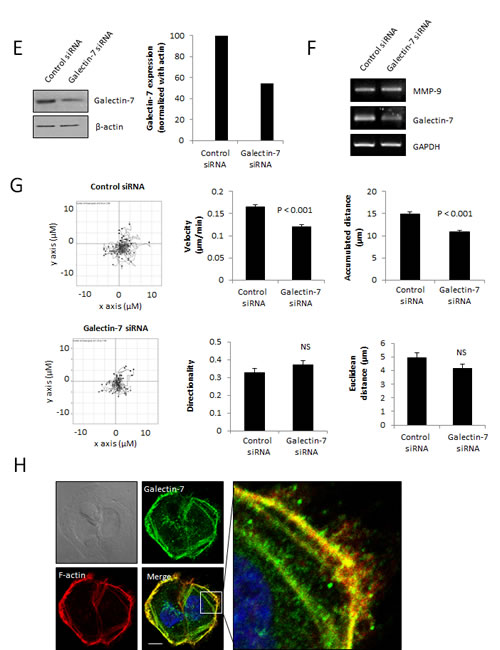 FIG4B