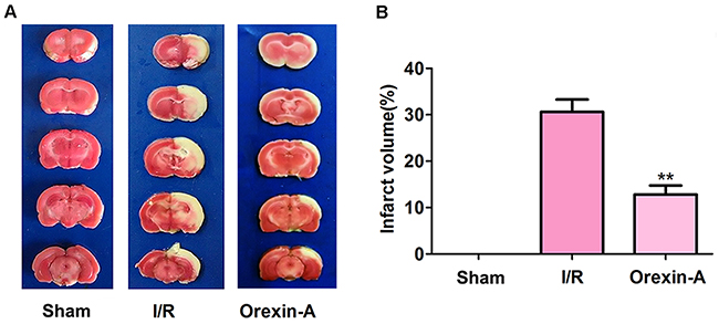 Orexin-A decreases the cerebral infarction volume following middle cerebral artery occlusion (MCAO) in rats.