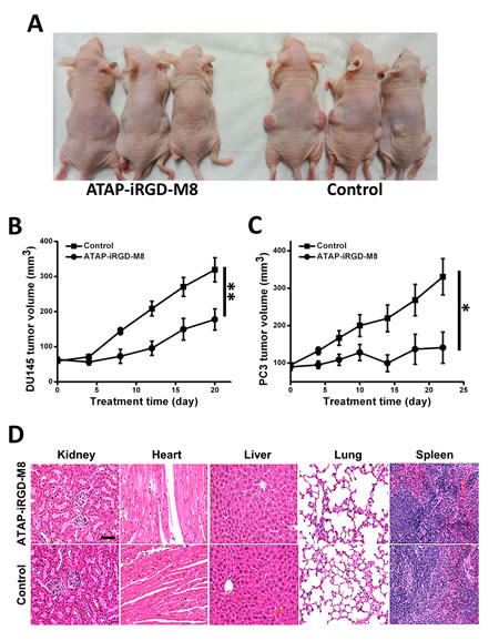 ATAP-iRGD-M8 suppresses prostate tumor growth with no toxic effects in xenograft model.