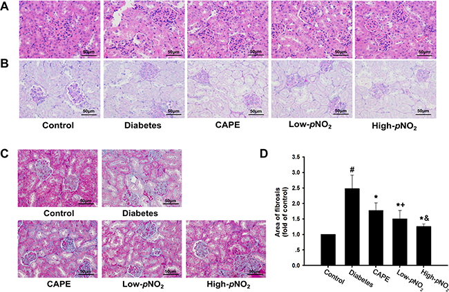 Effects of CAPE and CAPE-pNO2 treatment on the kidney structure and fibrosis in diabetic mice.