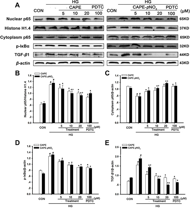 CAPE and CAPE-pNO2 treatment suppressed TGF-&#x03B2;1 expression via the NF-&#x03BA;B pathway in HG-induced GMCs.