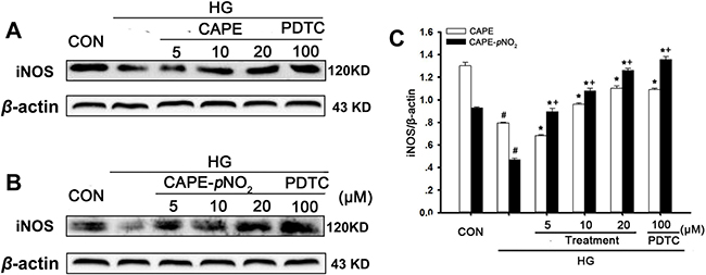 Effects of CAPE and CAPE-pNO2 treatment on iNOS expression in HG-induced GMCs.