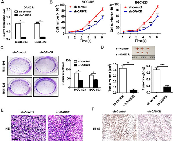 DANCR knockdown inhibits the proliferation of gastric cancer cells in vitro and in vivo.