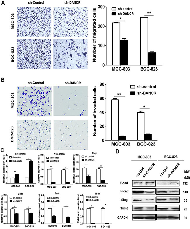 DANCR knockdown inhibits the migration and invasion of gastric cancer cells.