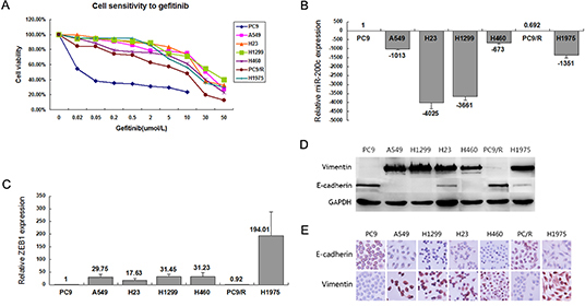 Phenotype and sensitivity to gefitinib in 7 NSCLC cell lines.