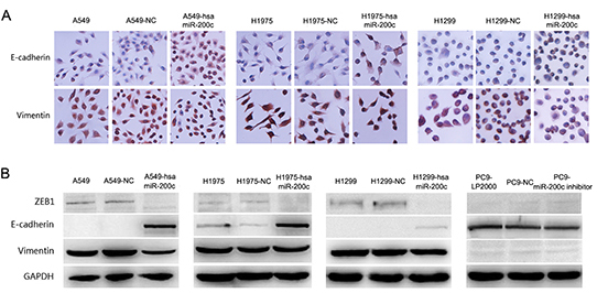 Over expression of miR-200c can restore epithelial phenotype in NSCLC.