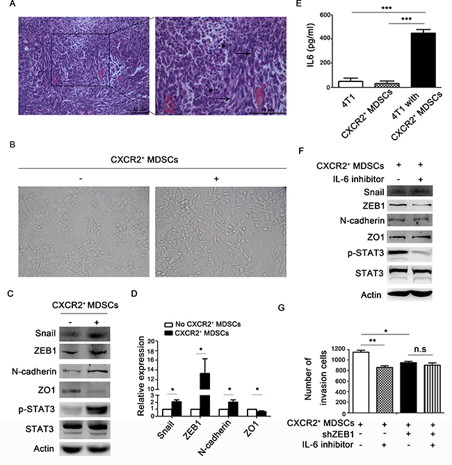 CXCR2+ MDSCs induce breast cancer cells EMT.