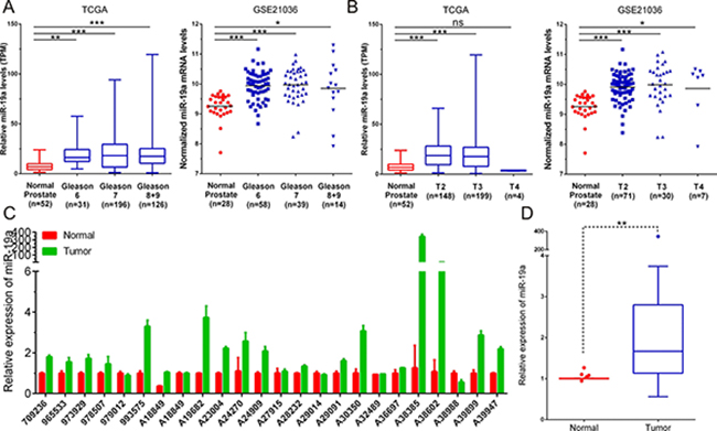 MiR-19a is up-regulated in prostate cancer tissue samples.