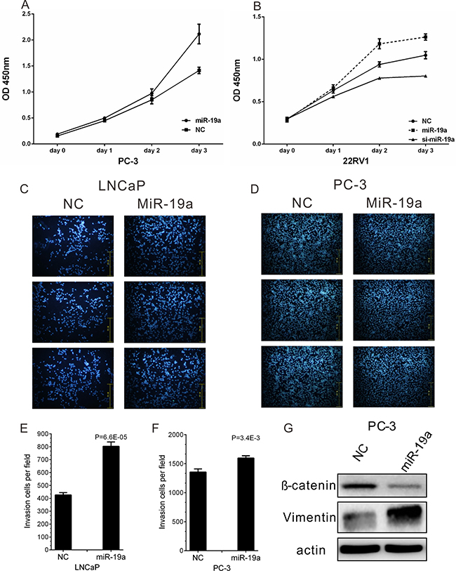 MiR-19a promotes cell proliferation and migration of PCa cells.