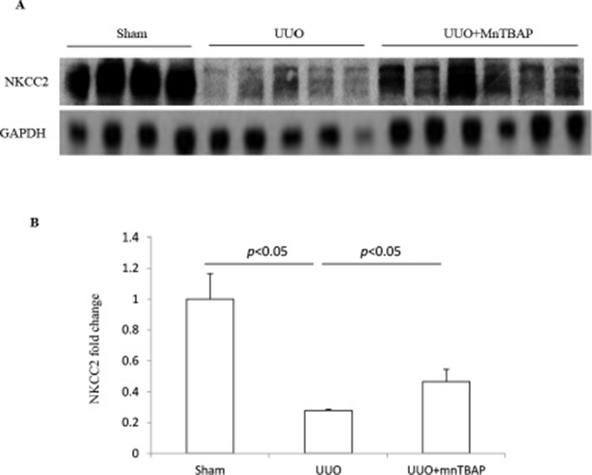 Protein expression of NKCC2 in obstructed kidneys following MnTBAP treatment.