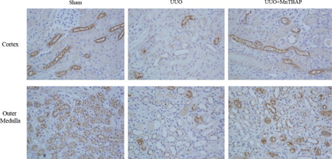 Immunohistochemistry of NKCC2 in obstructed kidneys following MnTBAP treatment.