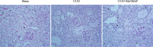PAS staining in obstructed kidneys following MnTBAP treatment.