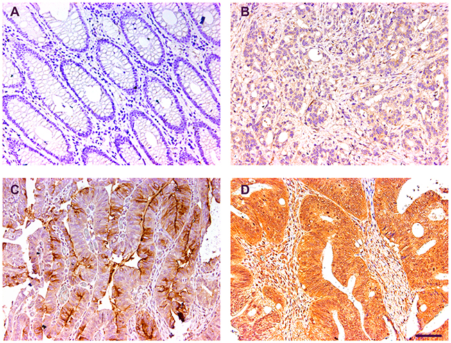 Representative immunohistochemical images of the CST1 expression.