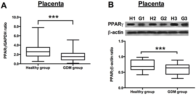 PPAR&#x03B3; expression in the placenta from healthy pregnant and GDM subjects.