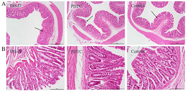 The structure of the intestinal mucosa after H&#x0026;E staining in three groups.