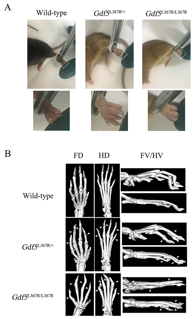 Skeletal abnormalities in GDF5SYM1 mice.