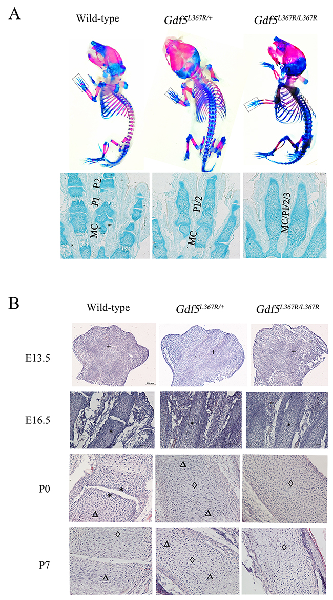 Joint formation abnormalities in GDF5SYM1 mice during limb development.