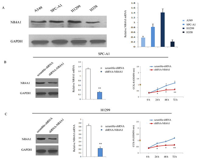 Transfection of shRNA-NR4A1 inhibited the proliferation of NSCLC cells.