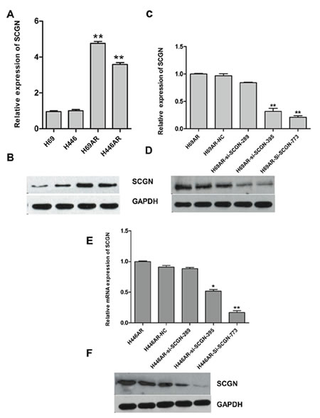 The expression of SCGN in SCLC cell lines.