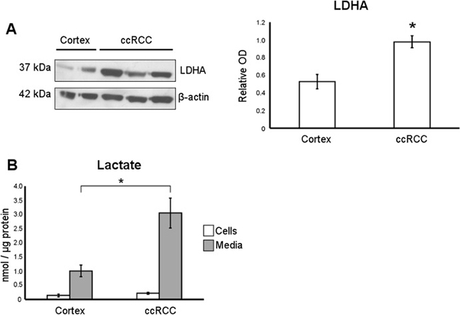Lactate production is upregulated in ccRCC primary cell cultures.