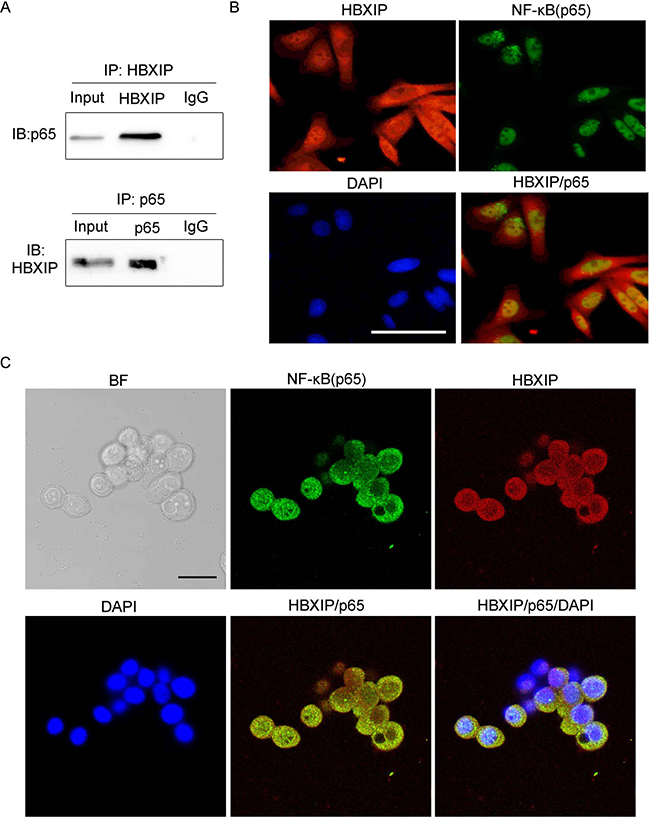 HBXIP binds to NF-&#x03BA;B(p65) in cancer cells.