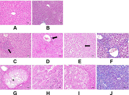 Histopathological examination of mice liver.