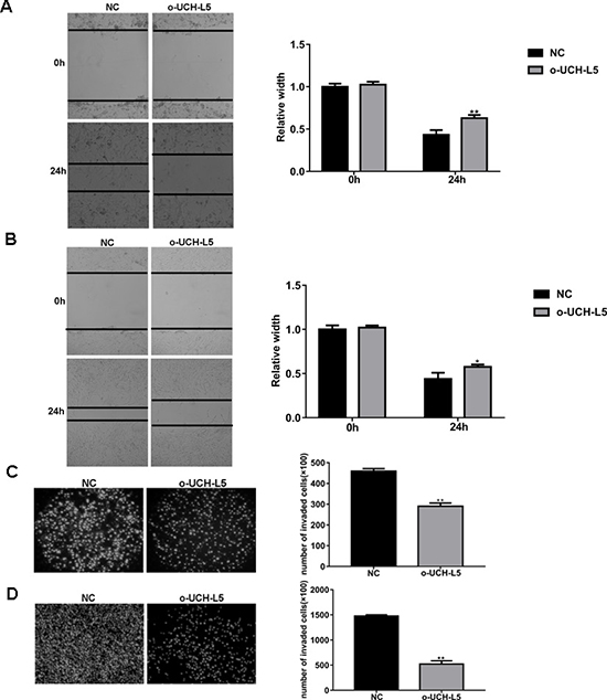Overexpression of UCH-L5 by lentivirus infection inhibits migration and invasion of glioma cells.