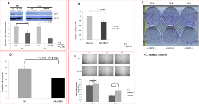 Reduced the proliferation rate and migration ability of human cancer cells (Caco-2) caused by EGFR knockdown.