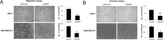 The knock-down of ANO1 decreases the invasiveness of breast cancer cells.