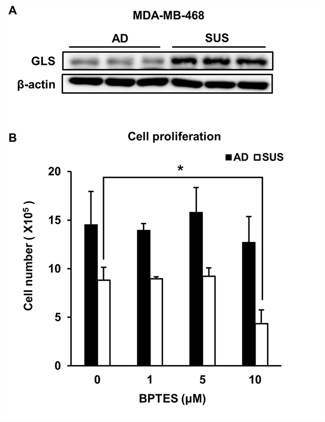 Suspension cells show an increase in GLS and are susceptible to treatment with GLS inhibitor.